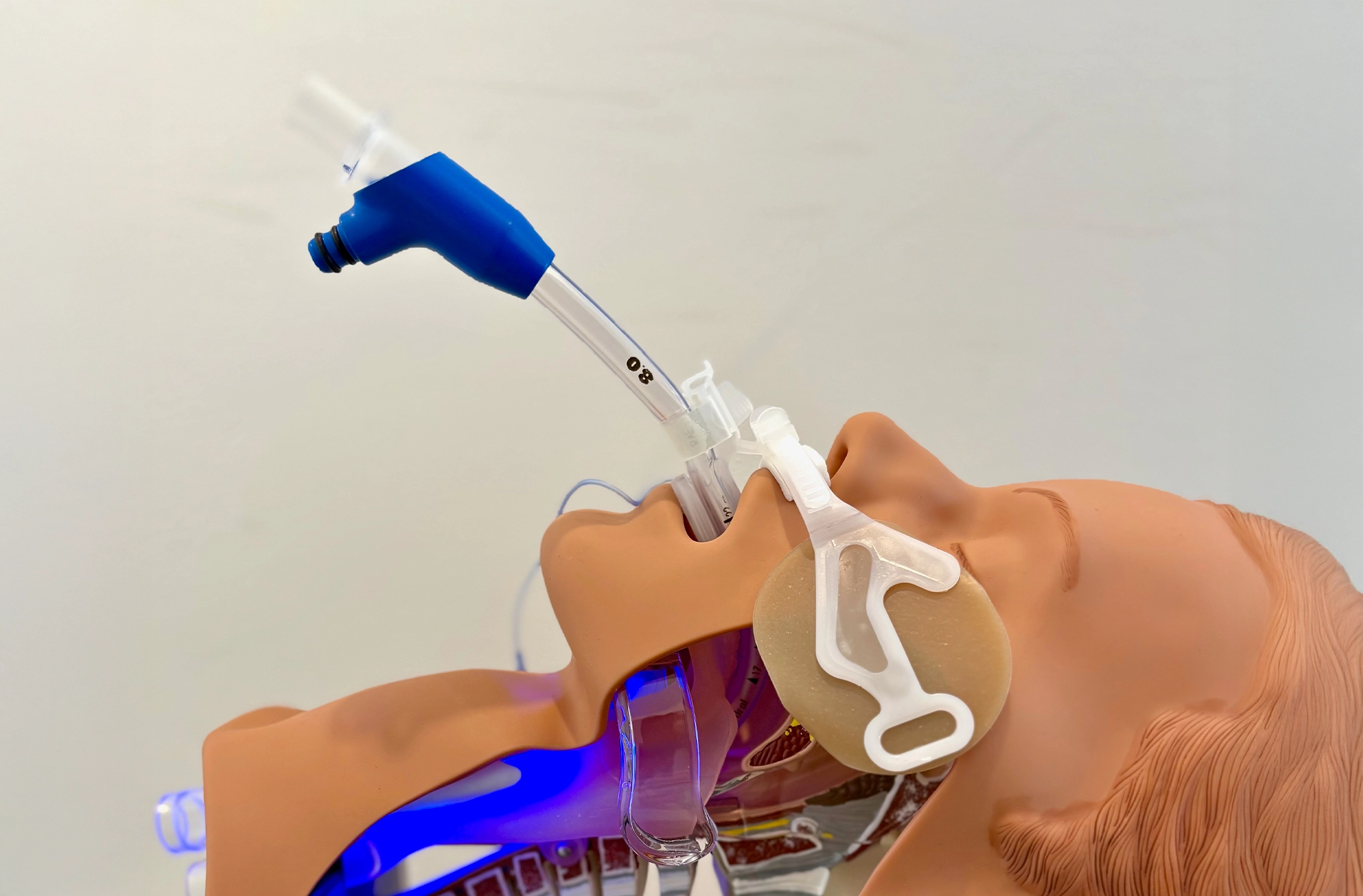 Woman in hospital bed